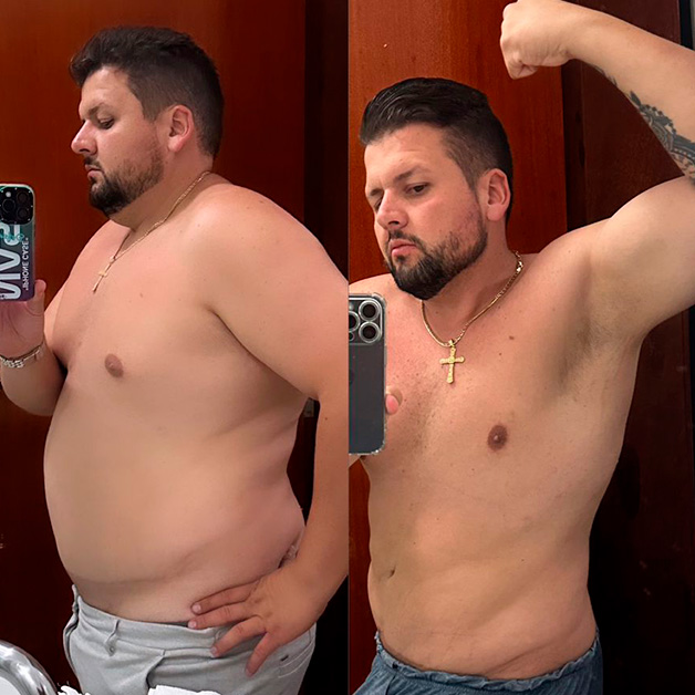 dr-bernardo-guimaraes-instituto-antes-e-depois01