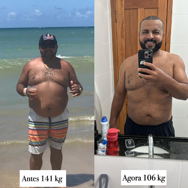 dr-bernardo-guimaraes-instituto-antes-e-depois04